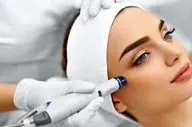عوارض لیزر در صورت مراجعه به افراد غیرمتخصص