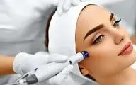 عوارض لیزر در صورت مراجعه به افراد غیرمتخصص