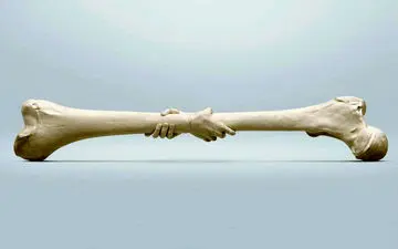  آشنایی با عوامل بروز پوکی استخوان