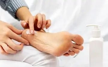 روش های مؤثر و خانگی برای درمان ترک  پا 