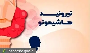 علایم یک بیماری خودایمنی شایع بر اثر اختلالات تیروئیدی را بشناسید