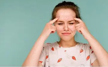 چرا آکنه و جوش در تابستان بیشتر می‌شود؟
