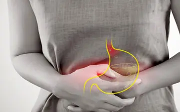 رفلاکس معده چیست و چه علائمی دارد؟