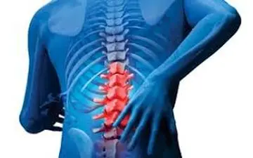 چه بیماریهایی باعث کمر درد می شوند؟