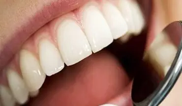  برای سلامت دندان‌هایتان این 7 خوراکی را نخورید