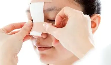 عوارض جراحی بینی را بشناسید