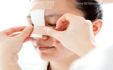 عوارض جراحی بینی را بشناسید