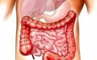 بهترین گیاه دارویی برای سلامت روده