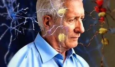 علائم پیر شدن غیرعادی مغز