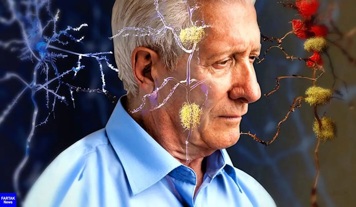 علائم پیر شدن غیرعادی مغز