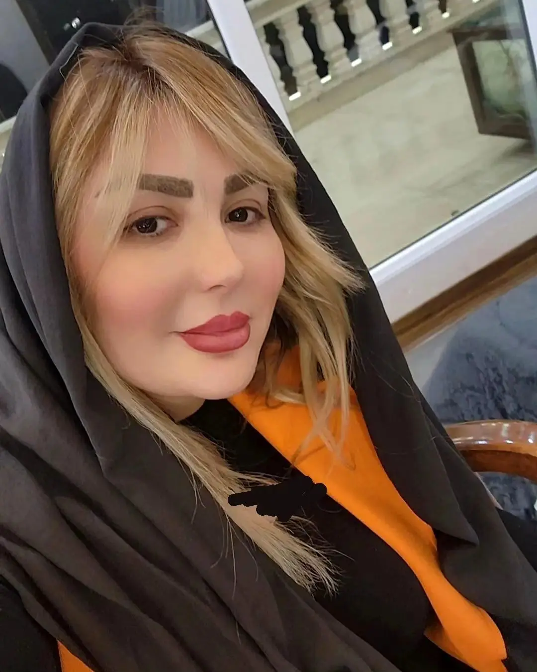 نیوشا ضیغمی بازیگر مطرح و سرشناس ایرانی عکسی را از خود رد اینستاگرام منتشر کرد که نشان می دهد چهره او بعد کلی جراحی به کلی زیر و رو شده است.