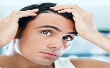 روش های جلوگیری از ریزش موی آقایان 