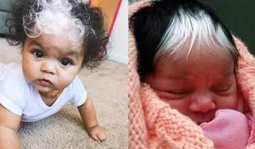 نوزادی با موهای عجیب +عکس