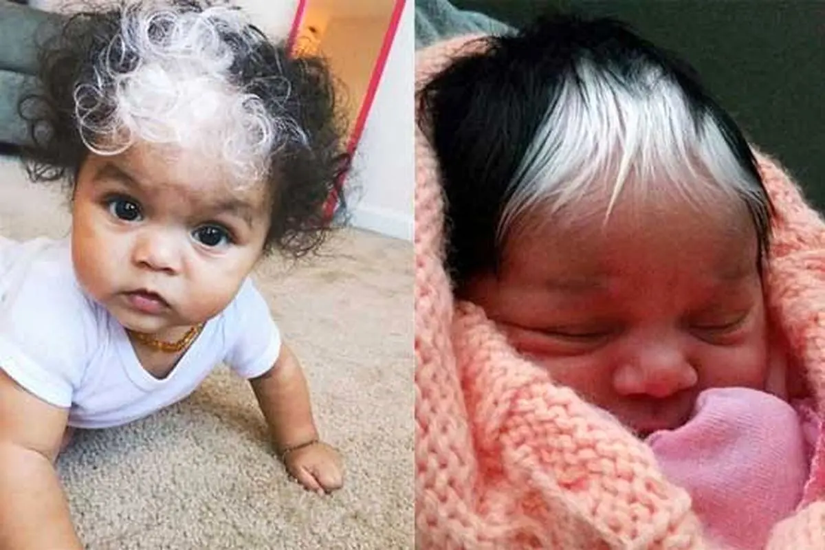 نوزادی با موهای عجیب +عکس