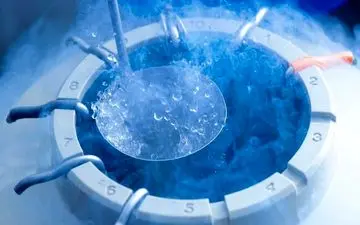 فریز کردن تخمک چیست و چگونه انجام می شود؛ سن و هزینه فریز تخمک