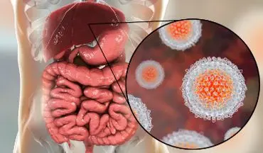 مهم ترین انواع هپاتیت های ویروسی!