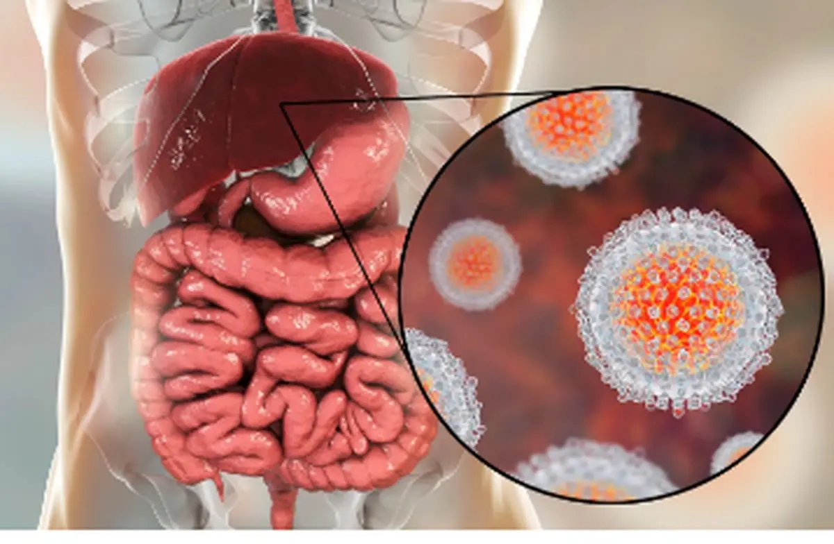 مهم ترین انواع هپاتیت های ویروسی!