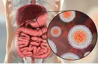 مهم ترین انواع هپاتیت های ویروسی!