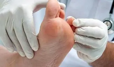 پژوهشگران دلیل بهبود نیافتن زخم‌ها را در ژن این موها پیدا کردند