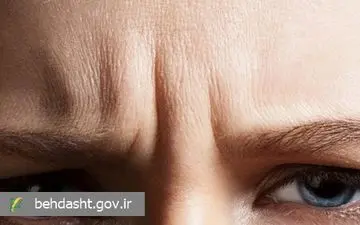 بیش از ۸۰ درصد آسیب‌های پوستی ریشه در کودکی دارد