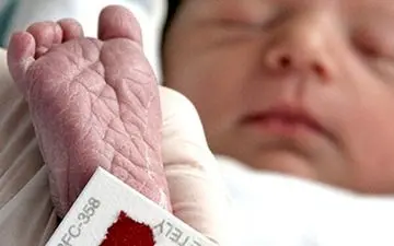 کم کاری تیروئید نوزادان را عقب مانده می کند