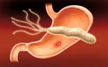 اگر به دنبال چاقی هستید بخوانید!