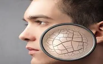 ۱۰ توصیه برای مراقبت از پوست در برابر آلودگی هوا