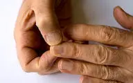 از رشد ناخن تا بیماری‌های پنهان؛ ناخن‌ها، پنجره‌ای به سوی سلامت شما!
