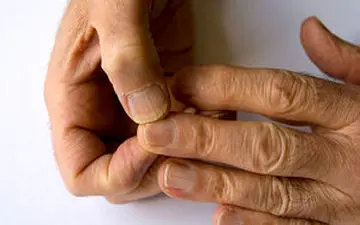 از رشد ناخن تا بیماری‌های پنهان؛ ناخن‌ها، پنجره‌ای به سوی سلامت شما!
