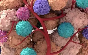 یک فناوری امیدوارکننده‌ برای درمان تومور‌ها شناسایی شد