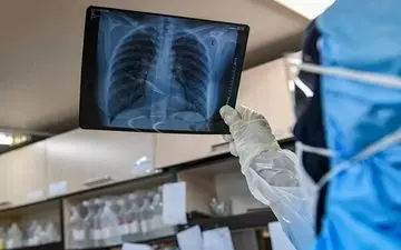 کرونا همچنان فوتی می گیرد / آمار جهانی کرونا را بدانید 