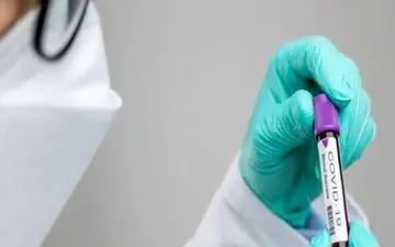 رکورد کرونا در آذربایجان‌شرقی با ۹۶ نفر مورد مثبت در یک روز زده شد