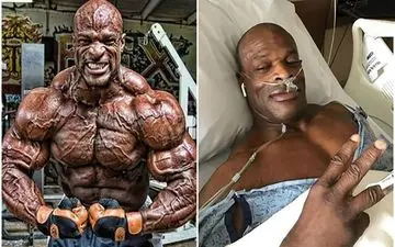  رونی کلمن  از روزگار سخت خود گفت