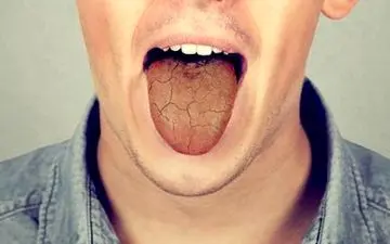 اگر در گرما بیش ازحد دهانتان خشک می شود، بخوانید