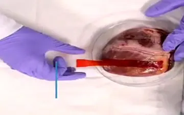 اختراع چسب زخمی از جنس هیدروژل برای زخم‌های داخلی! +فیلم