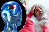 چرا سکته مغزی در مردان بیشتر از زنان است؟