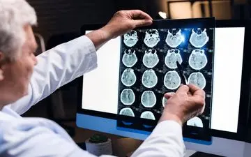 پایان آلزایمر نزدیک است؟ کشف عنصری شگفت‌انگیز برای سلامت مغز!