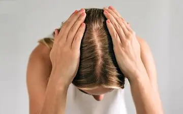 
ریزش مو دارید و از طاس شدن می ترسید؟ این مطلب را بخوانید