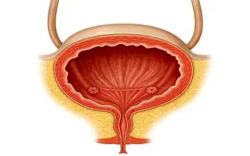 این عادات به مثانه فشار می آورد!